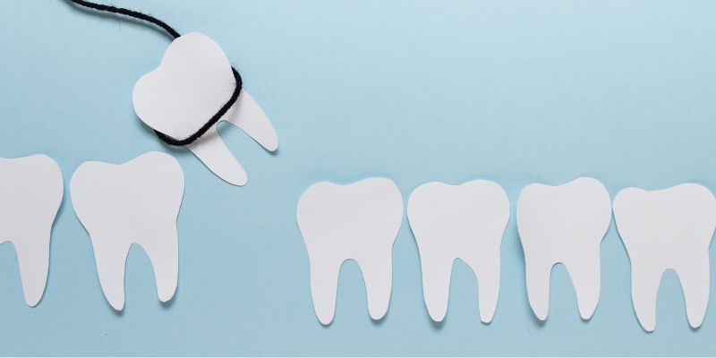 Featured image showing dental tools or an extraction diagram
